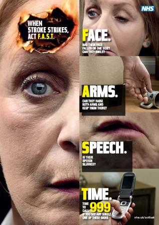 Stroke Service